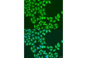 Immunofluorescence analysis of U2OS cells using STAT5A antibody (ABIN2737605) at dilution of 1:100. (STAT5A 抗体)