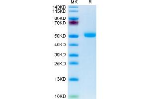 Human FSHB on Tris-Bis PAGE under reduced condition. (FSHB Protein (AA 19-129) (Fc Tag))