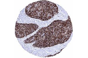 Immunohistochemistry (IHC) image for anti-Solute Carrier Family 2 (Facilitated Glucose Transporter), Member 1 (SLC2A1) (AA 203-305) antibody (ABIN7477481)