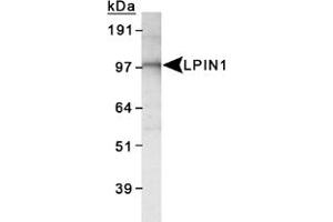 Western blot analysis of LPIN1 in 3T3-L1 lysate using LPIN1 polyclonal antibody . (Lipin 1 抗体  (AA 300-400))