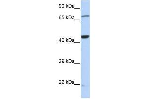 TUFM antibody used at 1 ug/ml to detect target protein. (TUFM 抗体  (Middle Region))