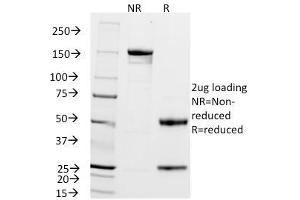 SDS-PAGE Analysis Purified ZAP70 Mouse Monoclonal Antibody (2F3. (ZAP70 抗体  (AA 1-254))