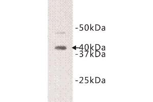 Western Blotting (WB) image for anti-Interleukin 1 Receptor-Like 1 (IL1RL1) (Extracellular) antibody (ABIN1854924)