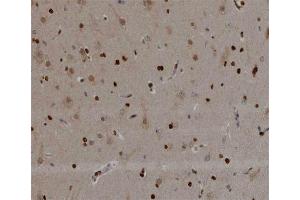 ABIN6266498 at 1/200 staining human brain tissue sections by IHC-P. (NOL3 抗体  (C-Term))