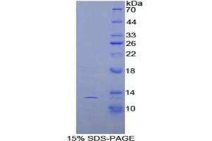 SDS-PAGE analysis of Rat Slit Homolog 3 Protein. (SLIT3 蛋白)