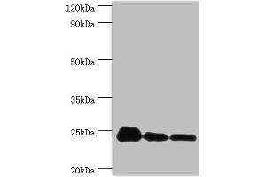 Western blot All lanes: PPIB antibody at 9 μg/mL Lane 1: NIH/3T3 whole cell lysate Lane 2: Hela whole cell lysate Lane 3: HepG2 whole cell lysate Secondary Goat polyclonal to rabbit IgG at 1/10000 dilution Predicted band size: 24 kDa Observed band size: 24 kDa (PPIB 抗体  (AA 34-216))