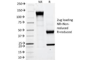 SDS-PAGE Analysis Purified CAIX Mouse Monoclonal Antibody (CA9/781). (CA9 抗体)