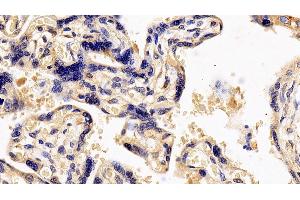 Immunohistochemistry (IHC) image for anti-Interleukin 13 Receptor, alpha 1 (IL13RA1) (AA 203-376) antibody (ABIN7437512)