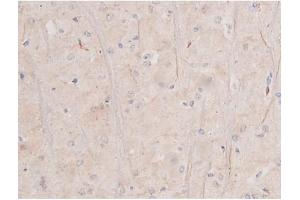 ABIN6255994 and ABIN6267364 at 1/200 staining Rat brain tissue sections by IHC-P. (KIT 抗体  (pTyr703))
