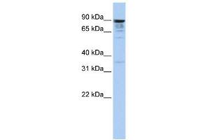 MCTP1 antibody used at 1 ug/ml to detect target protein. (MCTP1 抗体  (Middle Region))