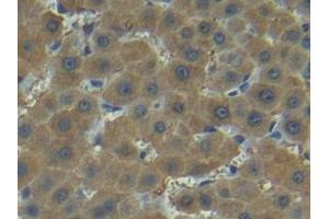 Detection of MMP7 in Human Liver Tissue using Polyclonal Antibody to Matrix Metalloproteinase 7 (MMP7) (MMP7 抗体  (AA 1-267))