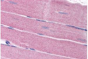 Human Skeletal Muscle (formalin-fixed, paraffin-embedded) stained with SORBS1 antibody ABIN297694 at 2. (SORBS1 抗体  (AA 1282-1294))