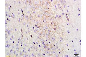 Formalin-fixed and paraffin embedded rat brain labeled with Anti-MMC3 Receptor/MC3-R Polyclonal Antibody, Unconjugated (ABIN872967) at 1:200 followed by conjugation to the secondary antibody and DAB staining. (MC3R 抗体  (AA 131-230))