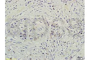 Immunohistochemistry (IHC) image for anti-Growth Factor Receptor-Bound Protein 2 (GRB2) antibody (ABIN686932)