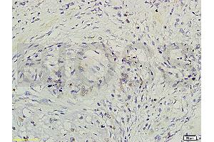 Formalin-fixed and paraffin-embedded rat brain labeled with Rabbit Anti-GRB2/ASH Polyclonal Antibody (ABIN686932) , Unconjugated 1:200 followed by conjugation to the secondary antibody and DAB staining (GRB2 抗体)