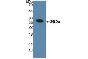 Detection of Recombinant MIB1, Human using Polyclonal Antibody to Mindbomb Homolog 1 (MIB1) (MIB1 抗体  (AA 769-1000))