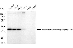 Western blotting analysis using Vasodilator stimulated phosphoprotein antibody (ABIN7800824).