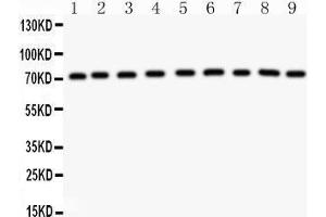 Anti-GHR antibody, Western blotting All lanes: Anti GHR  at 0. (Growth Hormone Receptor 抗体  (Middle Region))