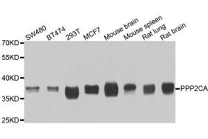 Western blot analysis of extracts of various cell lines, using PPP2CA antibody (ABIN5974047) at 1/1000 dilution. (PPP2CA 抗体)
