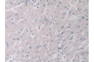 IHC-P analysis of Human Liver Tissue, with DAB staining. (MAPK12 抗体  (AA 27-311))