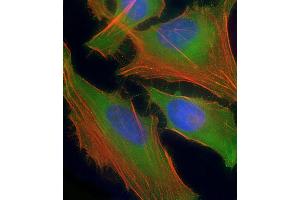 Immunofluorescent analysis of 4 % paraformaldehyde-fixed, 0. (ASS1 抗体  (AA 192-221))
