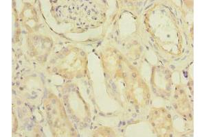 Immunohistochemistry of paraffin-embedded human kidney tissue using ABIN7163092 at dilution of 1:100 (PDCL2 抗体  (AA 1-241))