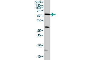STK4 monoclonal antibody (M02), clone 4F4 Western Blot analysis of STK4 expression in HeLa . (STK4 抗体  (AA 391-485))