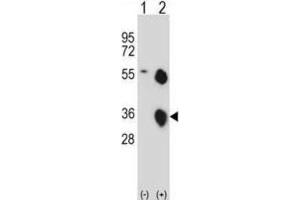 Western Blotting (WB) image for anti-Kallikrein 8 (KLK8) antibody (ABIN2997958)