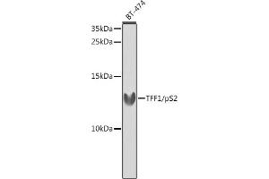 Western blot analysis of extracts of BT-474 cells, using TFF1/pS2 antibody (ABIN3015565, ABIN3015566, ABIN3015567 and ABIN6218896) at 1:1000 dilution. (TFF1 抗体  (pSer2))