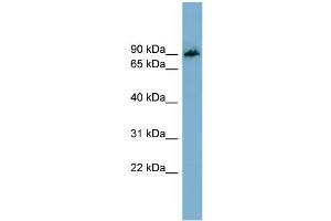 WB Suggested Anti-APBB1IP  Antibody Titration: 0. (Amyloid beta (A4) Precursor Protein-Binding, Family B, Member 1 Interacting Protein (APBB1IP) (N-Term) 抗体)