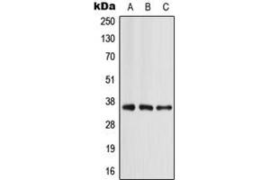 Western blot analysis of Apolipoprotein E expression in MCF7 (A), mouse liver (B), rat liver (C) whole cell lysates. (APOE 抗体  (Center))