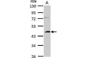 WB Image Casein Kinase 1 alpha 1L antibody detects CSNK1A1L protein by Western blot analysis. (CSNK1A1L 抗体)