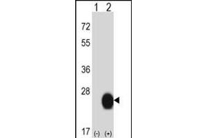 Western blot analysis of CSRP2 (arrow) using rabbit polyclonal CSRP2 Antibody (Center) (ABIN657989 and ABIN2846936). (CSRP2 抗体  (AA 68-96))