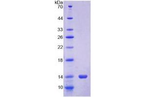 SDS-PAGE analysis of Cow S100A12 Protein. (S100A12 蛋白)
