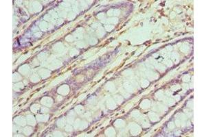 Immunohistochemistry of paraffin-embedded human colon tissue using ABIN7171965 at dilution of 1:100 (TAB1 抗体  (AA 205-504))