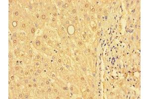 Immunohistochemistry of paraffin-embedded human liver tissue using ABIN7154103 at dilution of 1:100 (GSTM1 抗体  (AA 24-156))
