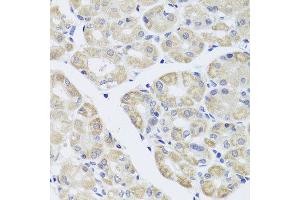 Immunohistochemistry of paraffin-embedded human stomach using DISC1 antibody at dilution of 1:100 (x40 lens). (DISC1 抗体)