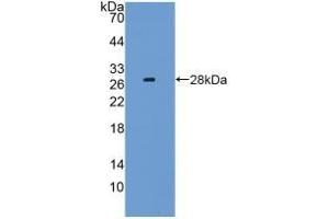 Detection of Recombinant LAG3, Mouse using Polyclonal Antibody to Lymphocyte Activation Gene 3 (LAG3) (LAG3 抗体  (AA 274-504))