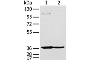 Western blot analysis of 293T and K562 cell using NUDT19 Polyclonal Antibody at dilution of 1:350 (NUDT19 抗体)