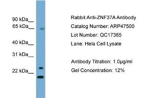 WB Suggested Anti-ZNF37A  Antibody Titration: 0. (ZNF37A 抗体  (Middle Region))