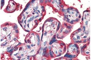 Human Placenta (formalin-fixed, paraffin-embedded) stained with Cholera Toxin antibody ABIN462099 at 10 ug/ml followed by biotinylated anti-mouse IgG secondary antibody ABIN481714, alkaline phosphatase-streptavidin and chromogen.