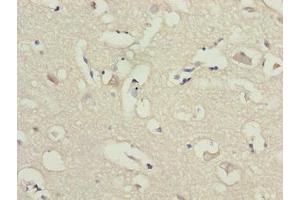 Immunohistochemistry of paraffin-embedded human brain tissue using ABIN7143514 at dilution of 1:100 (ARL6IP1 抗体  (AA 93-133))