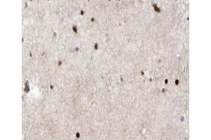 ABIN6266543 at 1/100 staining human brain tissue sections by IHC-P. (GAD 抗体  (C-Term))