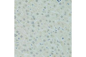 Immunohistochemistry of paraffin-embedded mouse liver using RCC1 antibody (ABIN5973761) at dilution of 1/100 (40x lens). (RCC1 抗体)