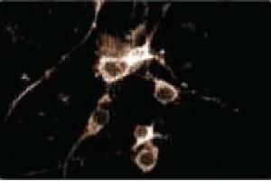 Immunofluorescence staining of rat cortical neurons. (COMT 抗体  (AA 26-141))