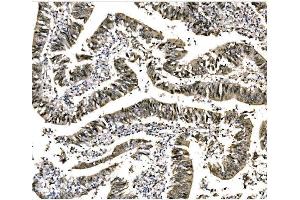 IHC analysis of EHMT2/G9A using anti-EHMT2/G9A antibody (ABIN7602084). (EHMT2 抗体  (AA 580-1195))