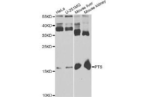 Western blot analysis of extracts of various cell lines, using PTS antibody. (PTS 抗体)