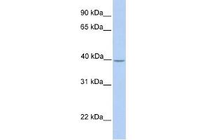 Western Blotting (WB) image for anti-SAM Domain, SH3 Domain and Nuclear Localization Signals, 1 (SAMSN1) (Middle Region) antibody (ABIN2782395)