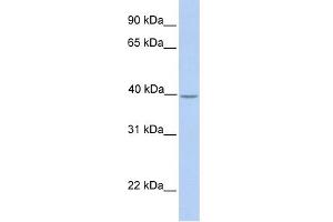 WB Suggested Anti-SAMSN1 Antibody Titration:  0.