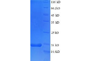 SDS-PAGE (SDS) image for Teratocarcinoma-Derived Growth Factor 1 (TDGF1) (AA 32-150), (partial) protein (His tag) (ABIN5712756) (TDGF1 Protein (AA 32-150, partial) (His tag))